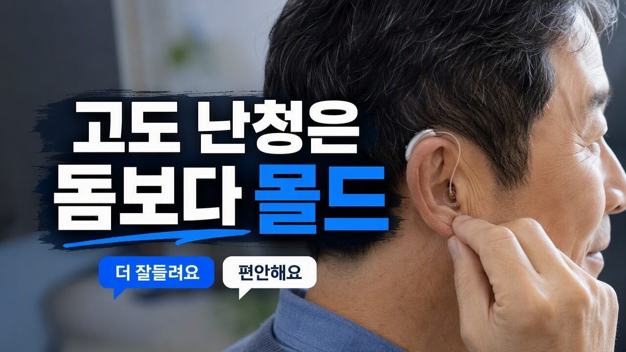보청기 맞춤형 이어몰드 vs 기성용 돔, 고도 난청일수록 몰드 재질(실리콘·하드)에서 갈리는 차이
